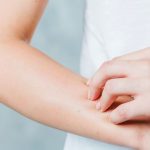 stressed skin-itch