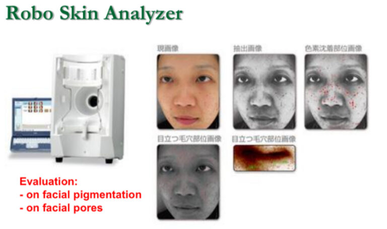 robo skin analyzer result